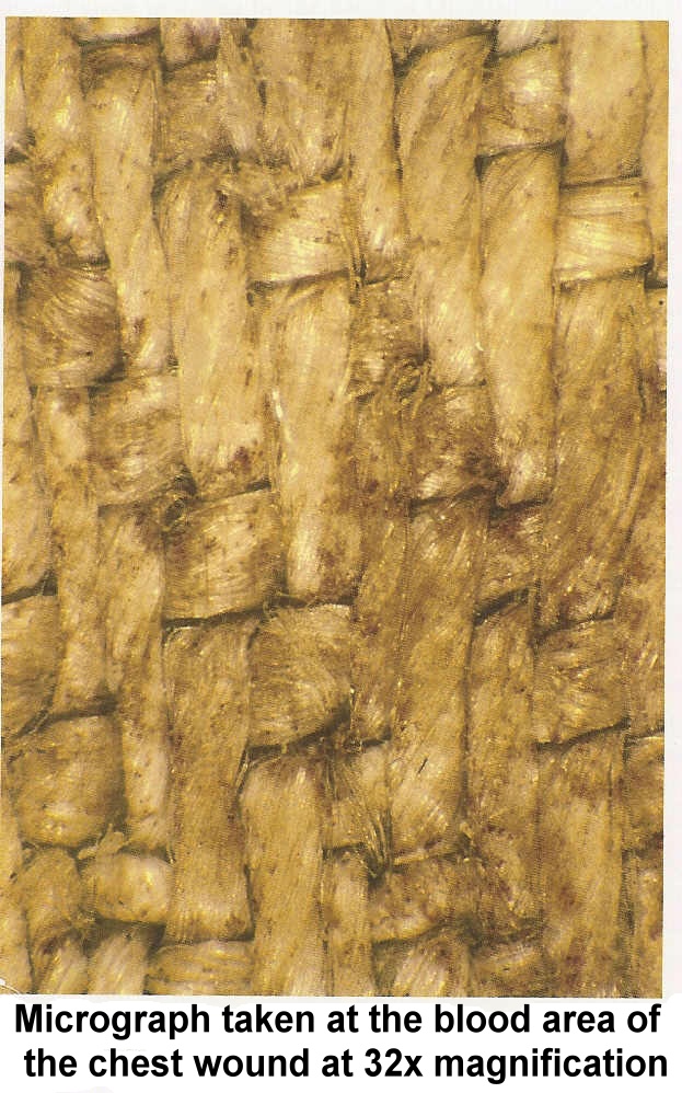 64x image of the nose area.