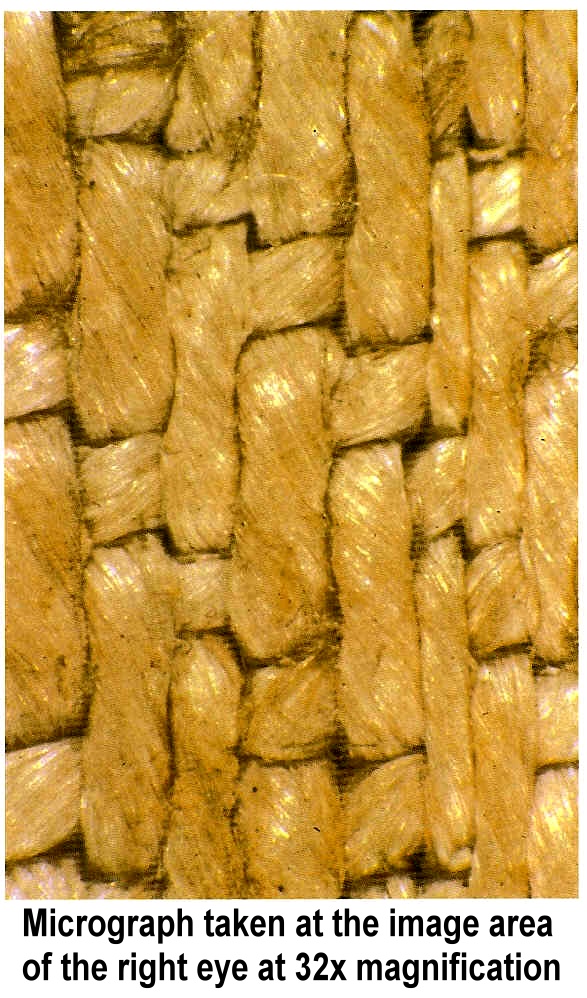 64x image of the nose area.
